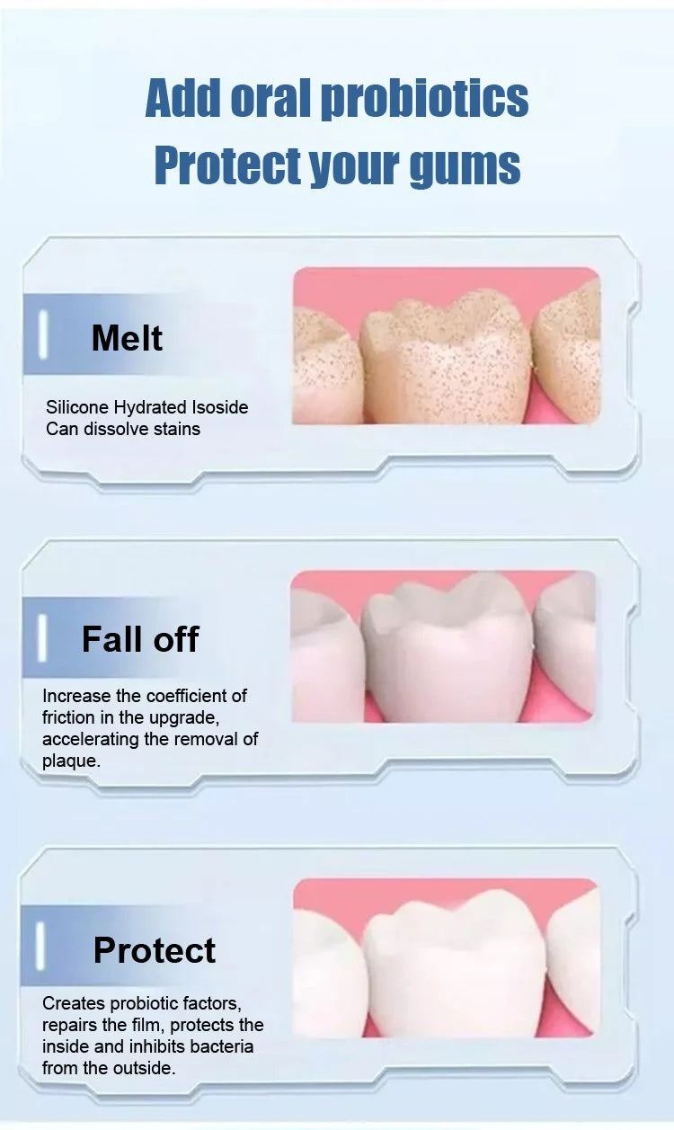 BERGATONIX SP-4 Probiotic Whitening Toothpaste (Pack of 4)